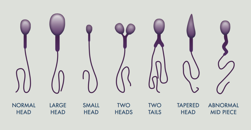 Semen Analysis Fertility Testing At Kindbody 